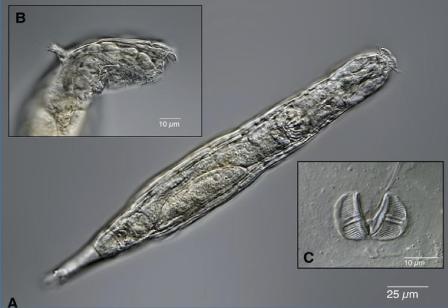 Rotifer from permafrost revived Image credits: Lyubov Skarkova / www.cell.com